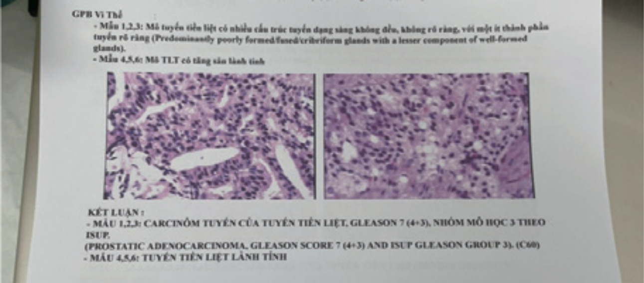 prostate-shearwave-fig8-pc