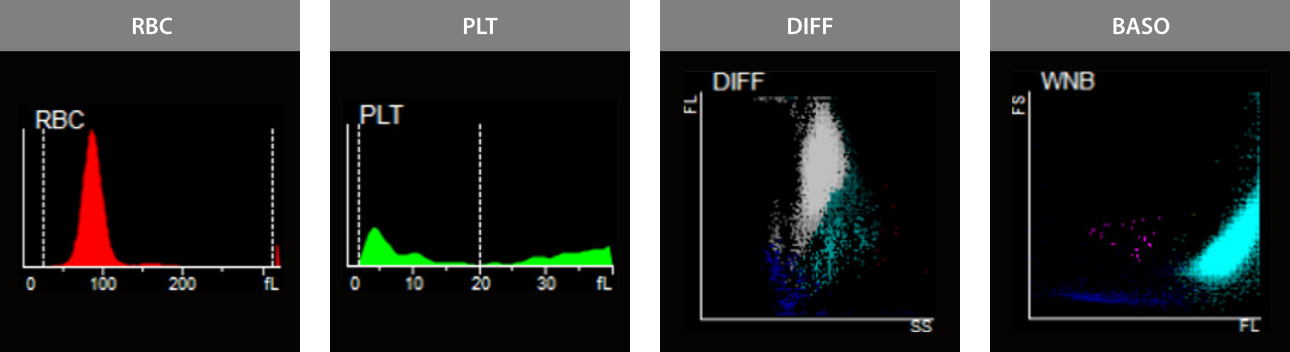 hemablog-1-aml-m4-fig2-pc