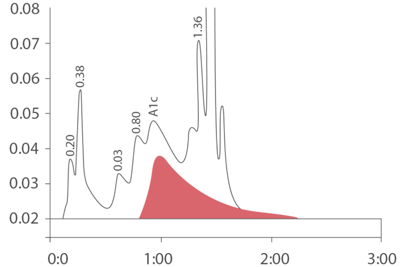 HPLC chromatogram