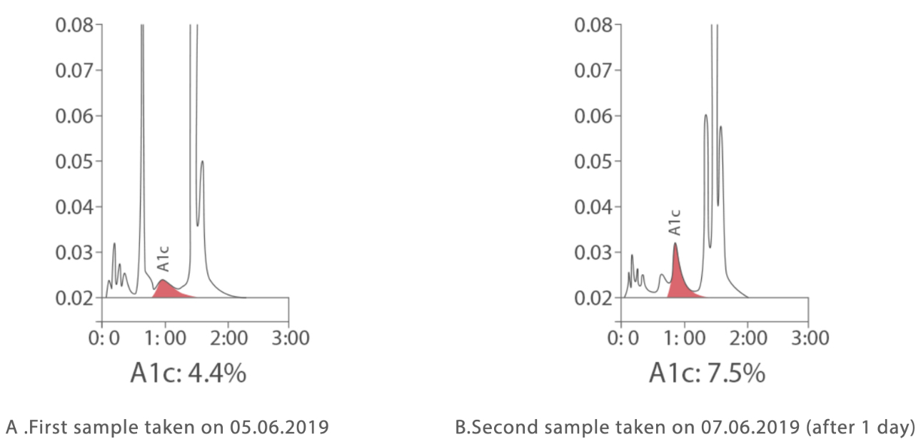 chromatogram