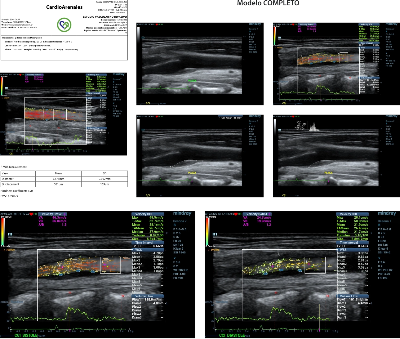 carotid-atherosclerotic-fig3-pc