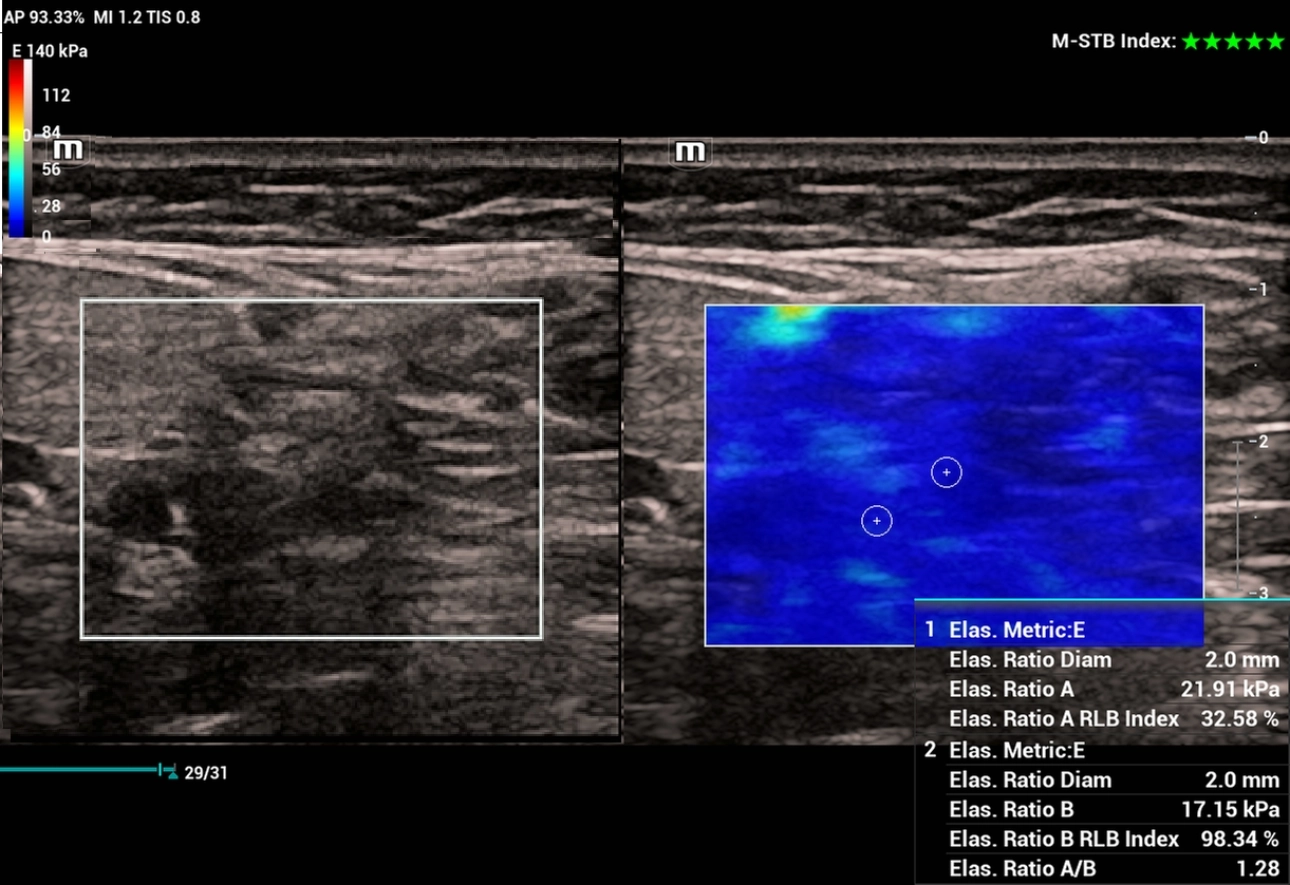 carotid-glomus-fig2-pc