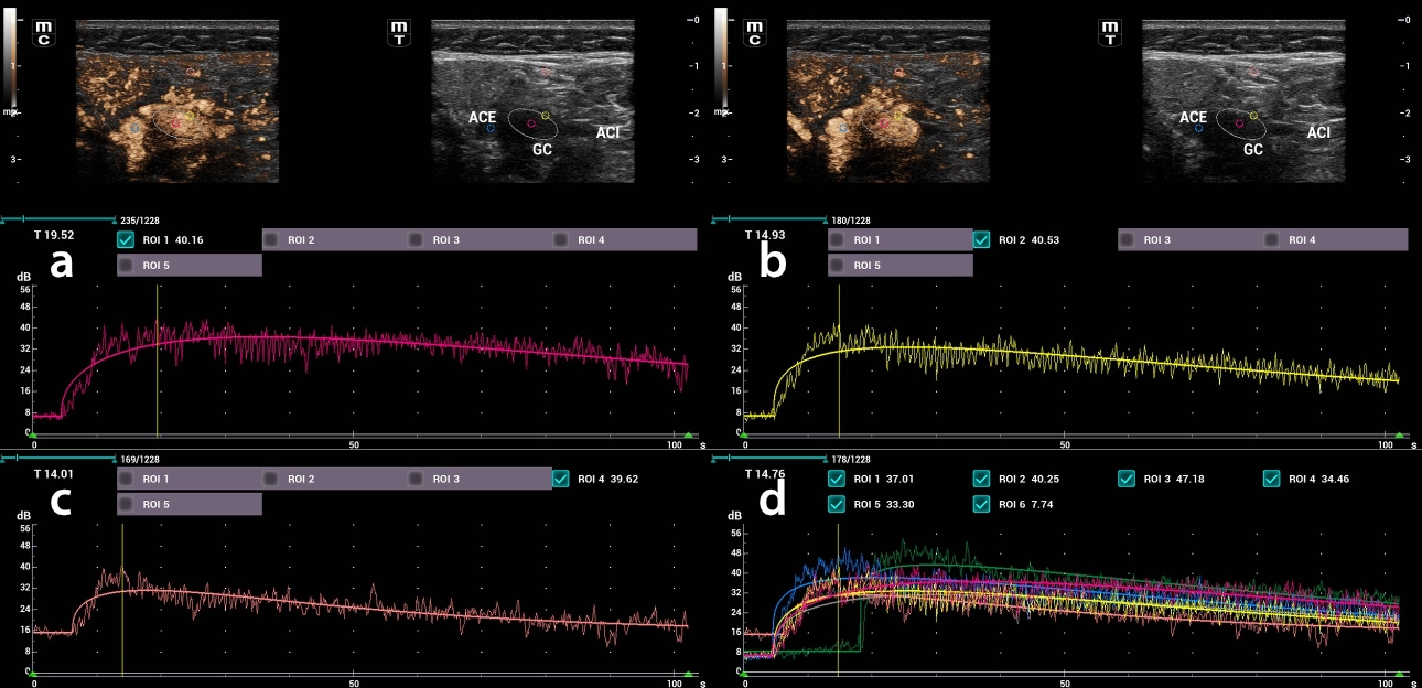 carotid-glomus-fig4-pc