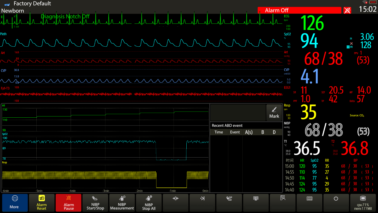 abd-analysis-nicu-fig1-pc