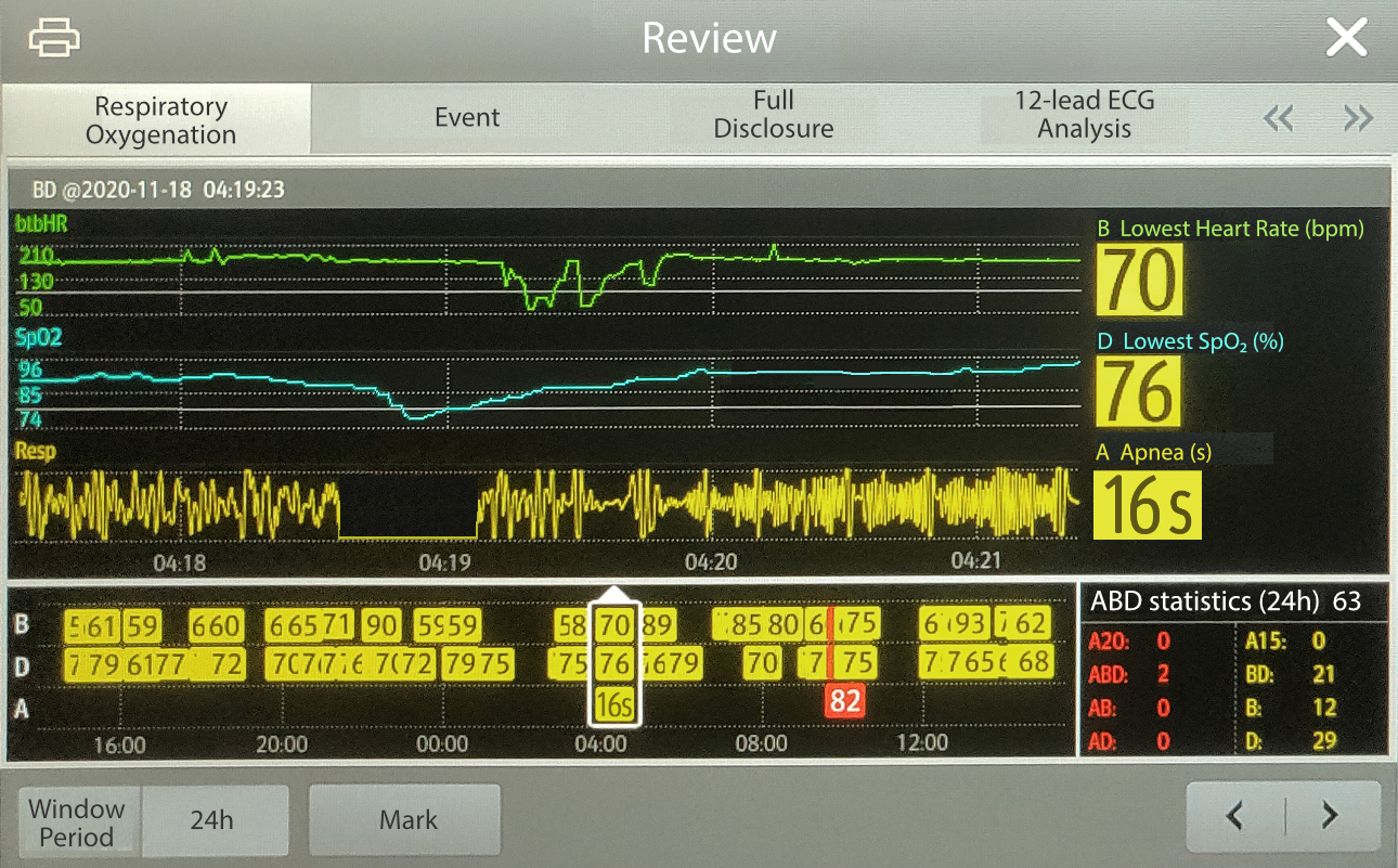 abd-analysis-nicu-fig4-pc