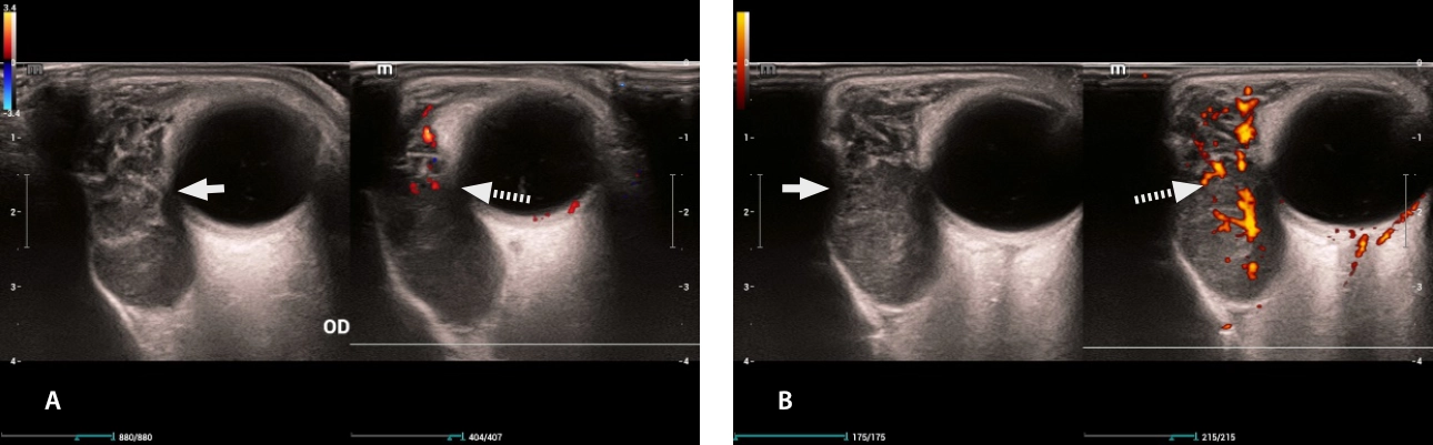 lymphoma-simulator-fig4-pc