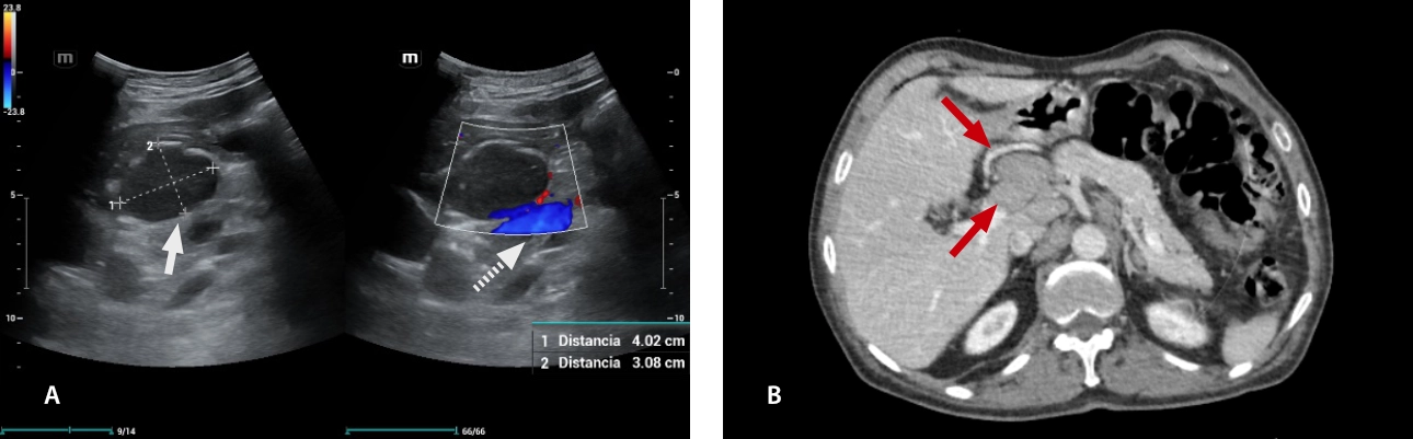 lymphoma-simulator-fig6-pc