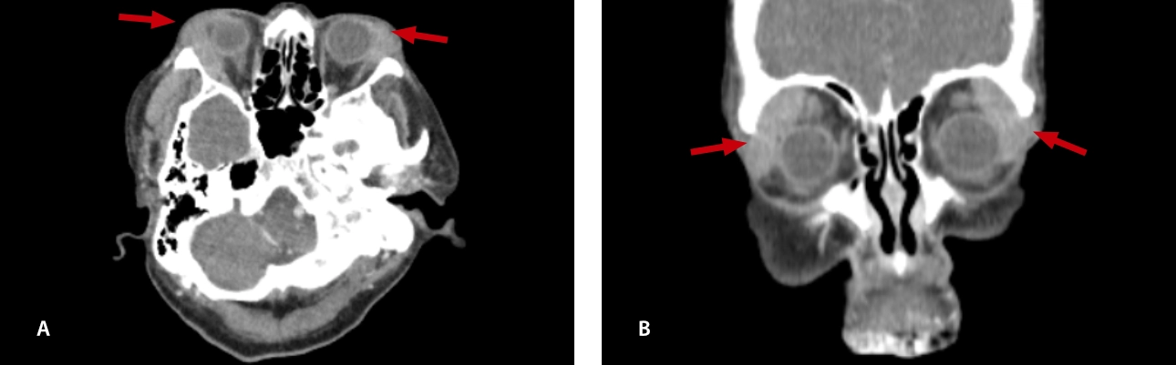 lymphoma-simulator-fig8-pc