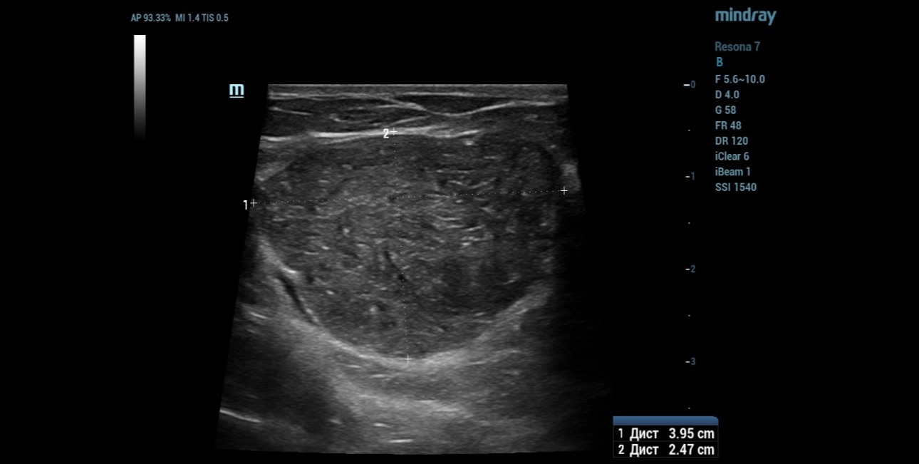 mammary-gland-fig1-pc