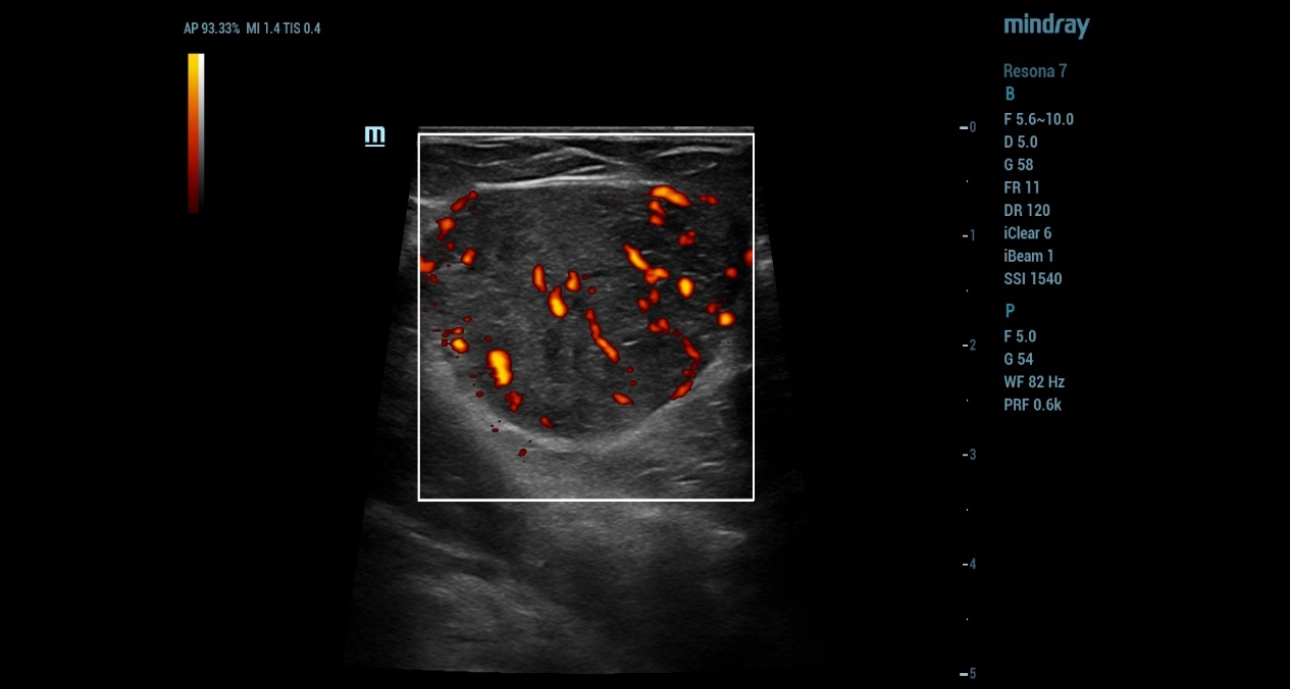 mammary-gland-fig2-pc