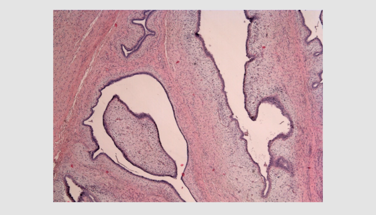 mammary-gland-fig7-pc