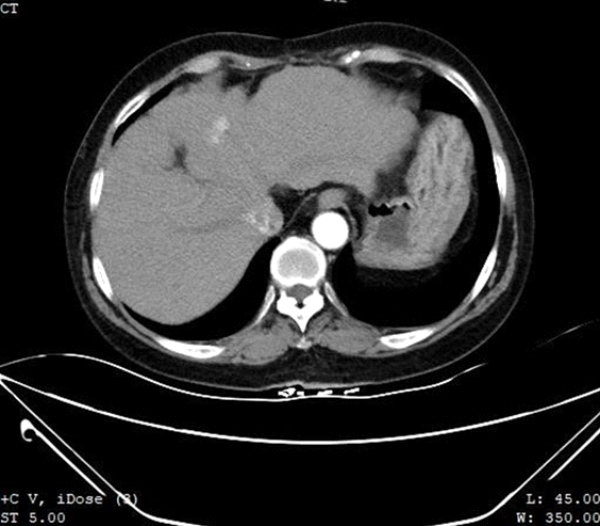 fusion-imaging-fig1