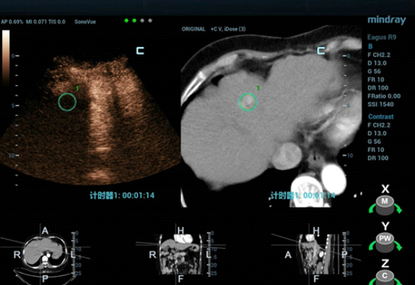 fusion-imaging-fig8-pc