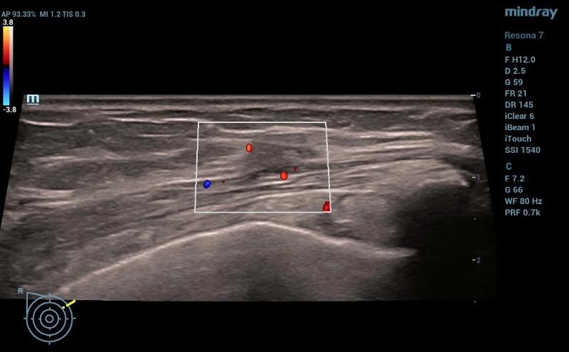 multiparametric-breast-mass-fig3