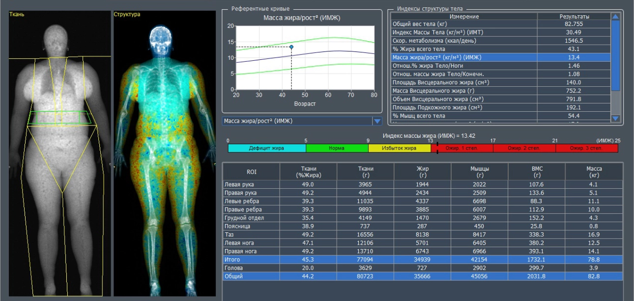 multiparametric-ultrasound-diagnosis-mafl-disease-fig3-pc