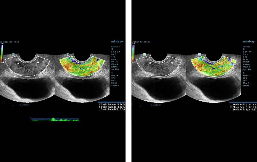 multiparametric-ultrasound-kv-pc