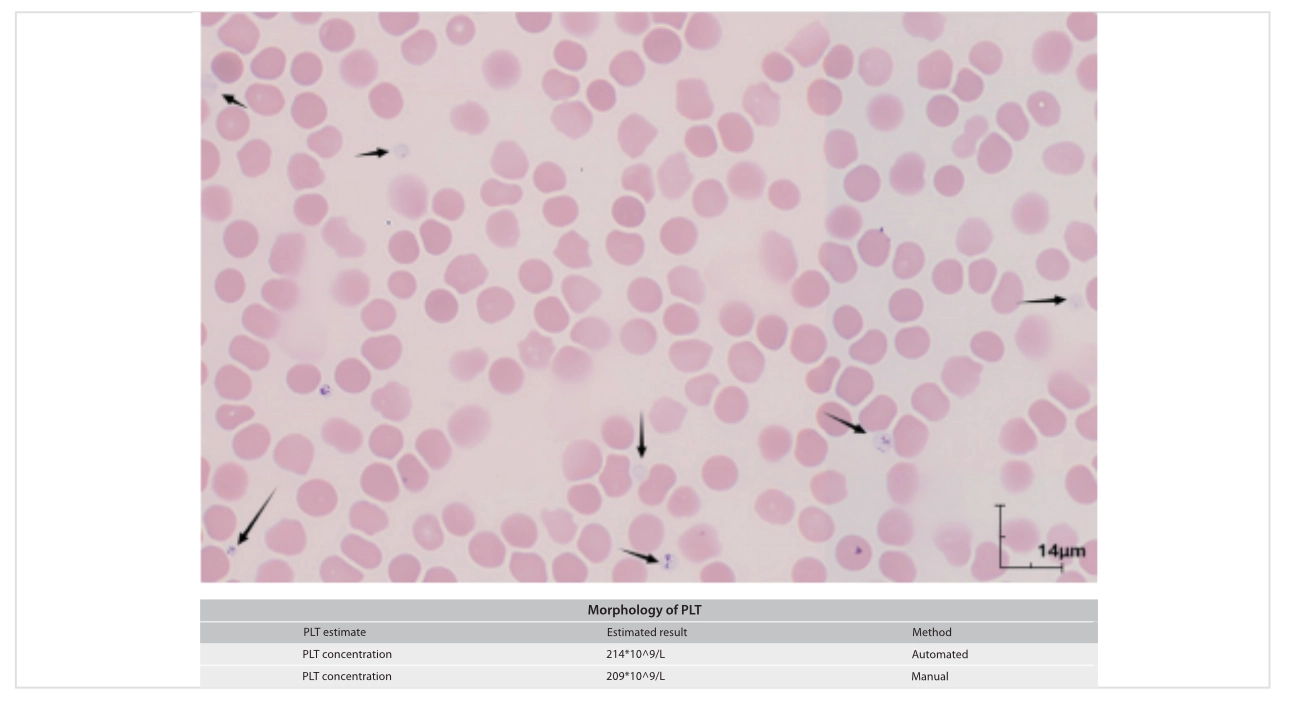 platelet-count-innovation-fig4