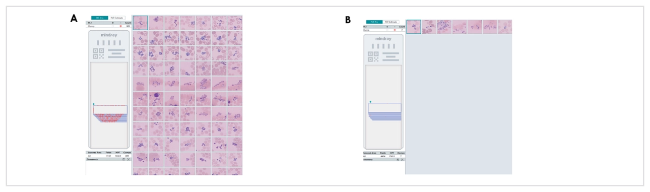 platelet-count-innovation-fig6