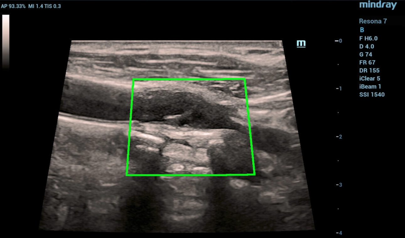 cardiovascular-pathology-fig1