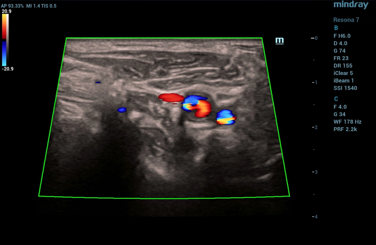 cardiovascular-pathology-fig3