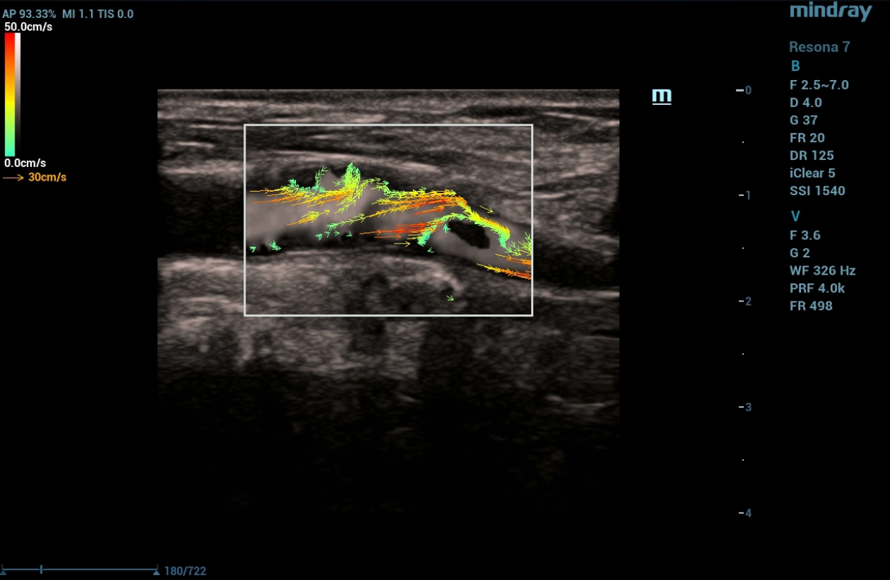 cardiovascular-pathology-fig4