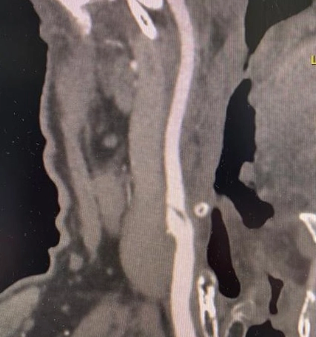 cardiovascular-pathology-fig9