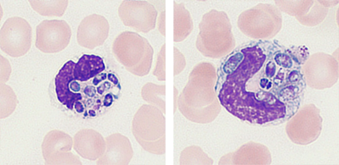 talaromyces-marneffei-fig4-pc