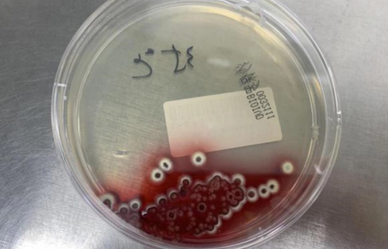 talaromyces-marneffei-fig5-pc