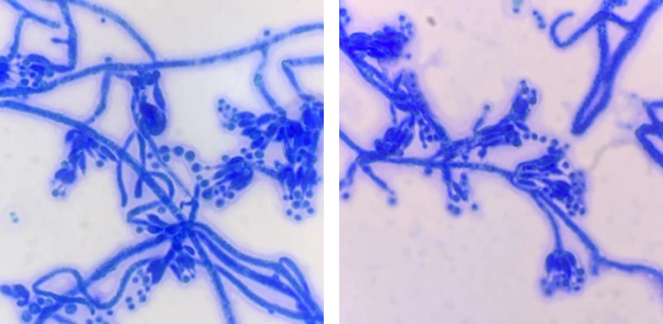 talaromyces-marneffei-fig7-pc