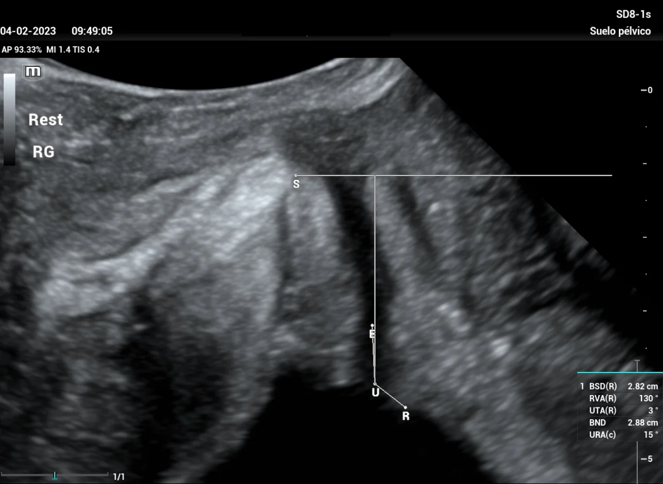 stress-urine-fig1