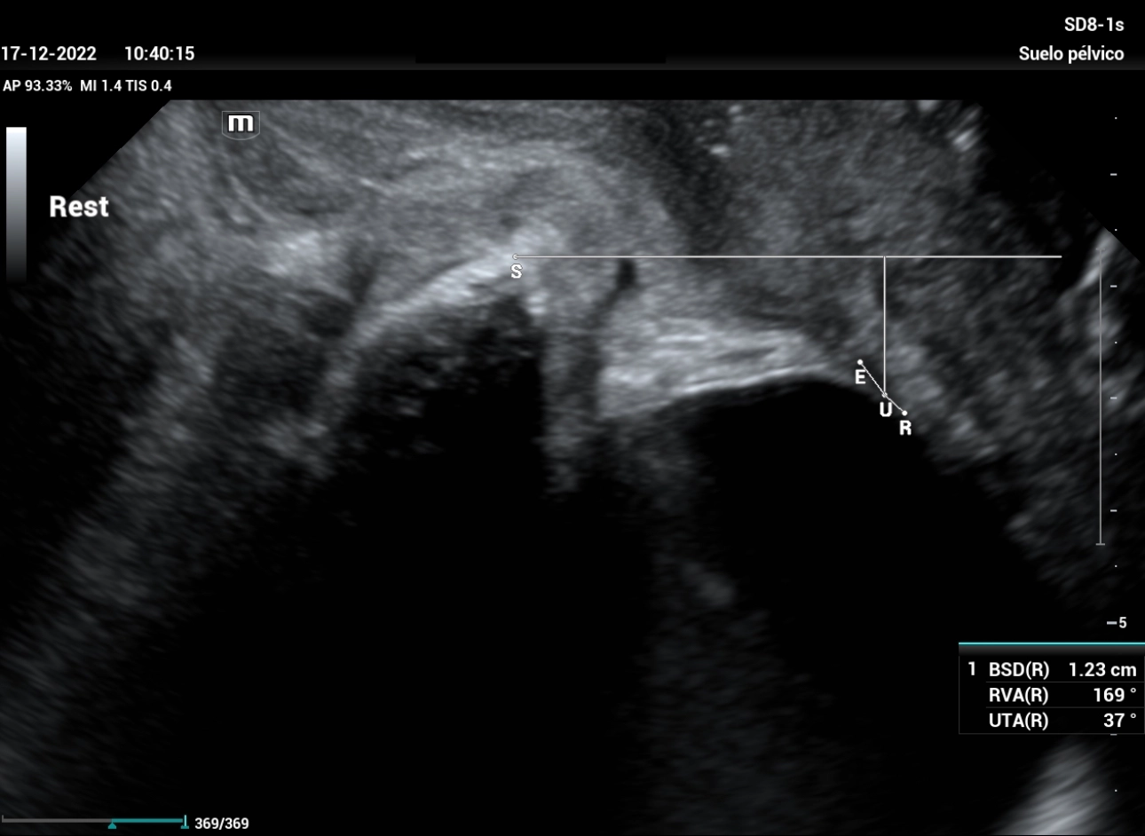 stress-urine-fig6