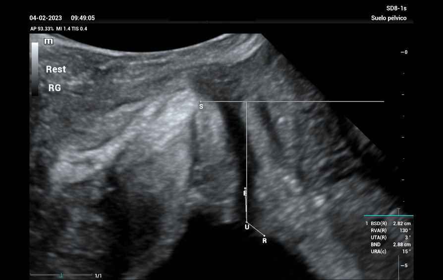 stress-urine-kv-pc