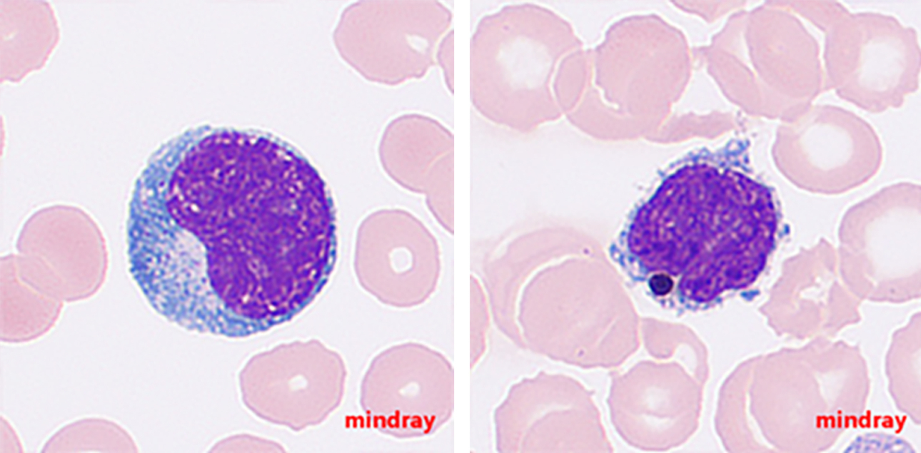 maurer-pigment-fig6-pc