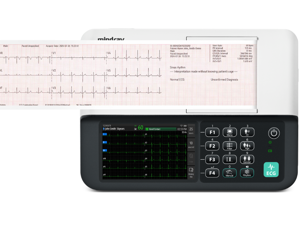 BeneHeart R300 product image