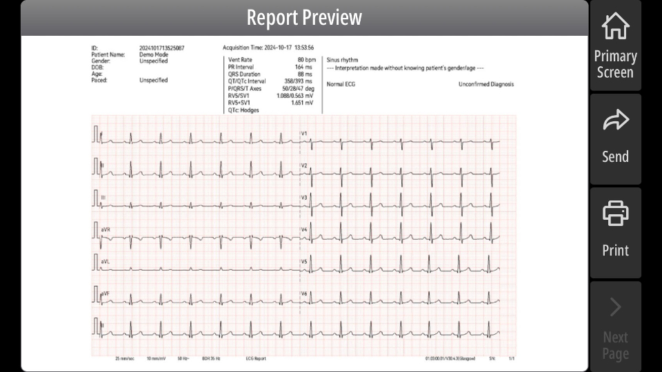 BeneHeart R300 - E-report transmission.