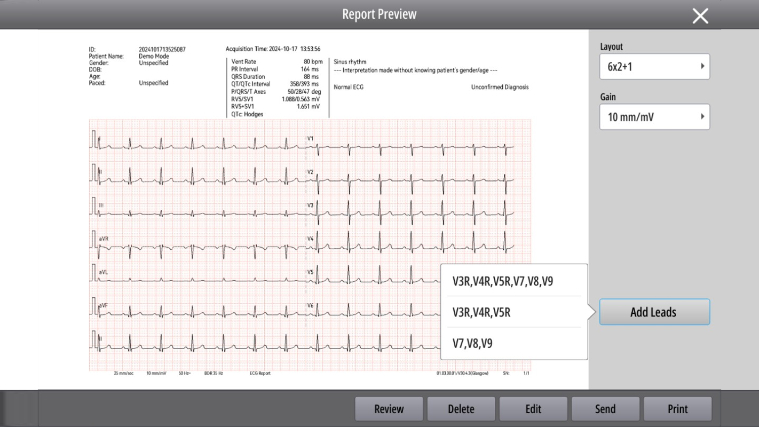 BeneHeart R700/R900 Electrocardiograph - Additional Leads Guidance report mode