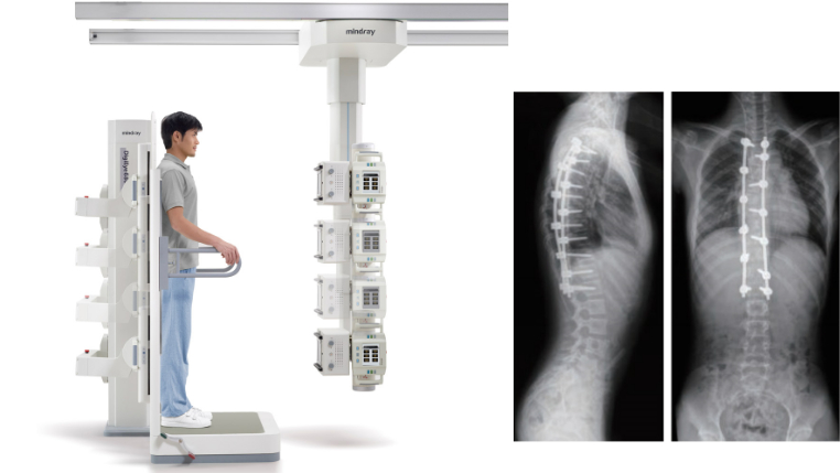 DigiEye 680 Digital Radiography System