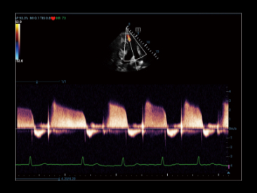 p63-s4-11-web