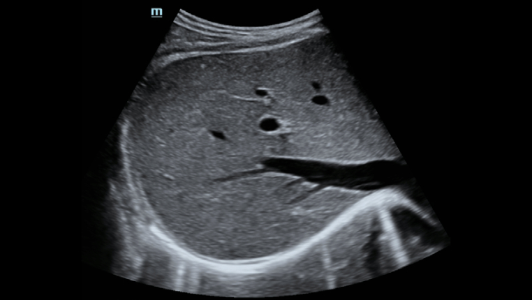 hepatus-series-fig10-4-pc