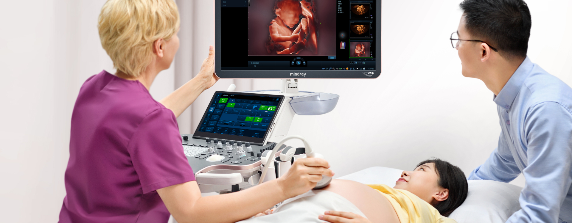 Nuewa R9 Platinum Edition Premium Ultrasound System