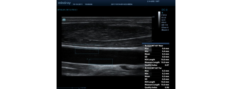 m9-fig12-pc