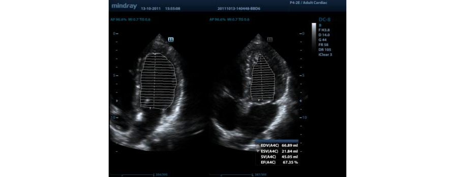 m9-fig13-pc