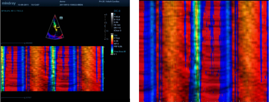 m9-fig9-pc