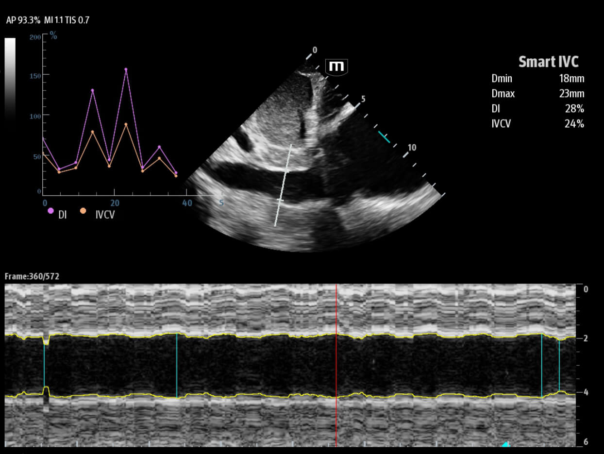 tex-20-fig8-7