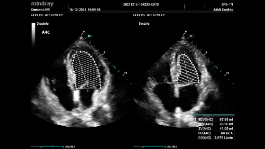 consona-n9-fig4-3