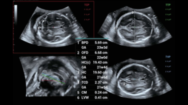 consona-n9-fig3-2-4