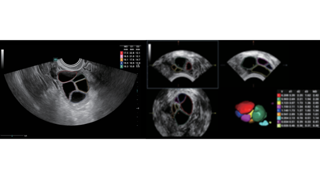 consona-n9-fig3-2-5