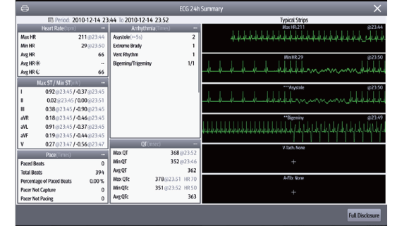 ccu-fig4-1-pc