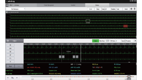 ccu-fig4-2-pc