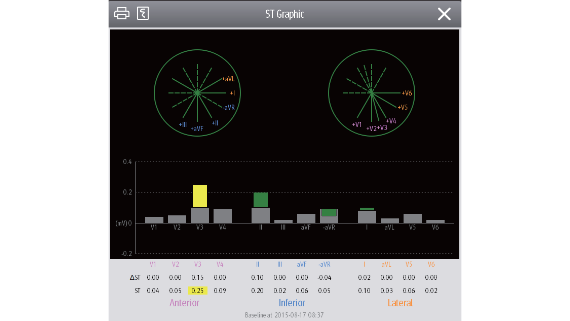 ccu-fig4-4-pc